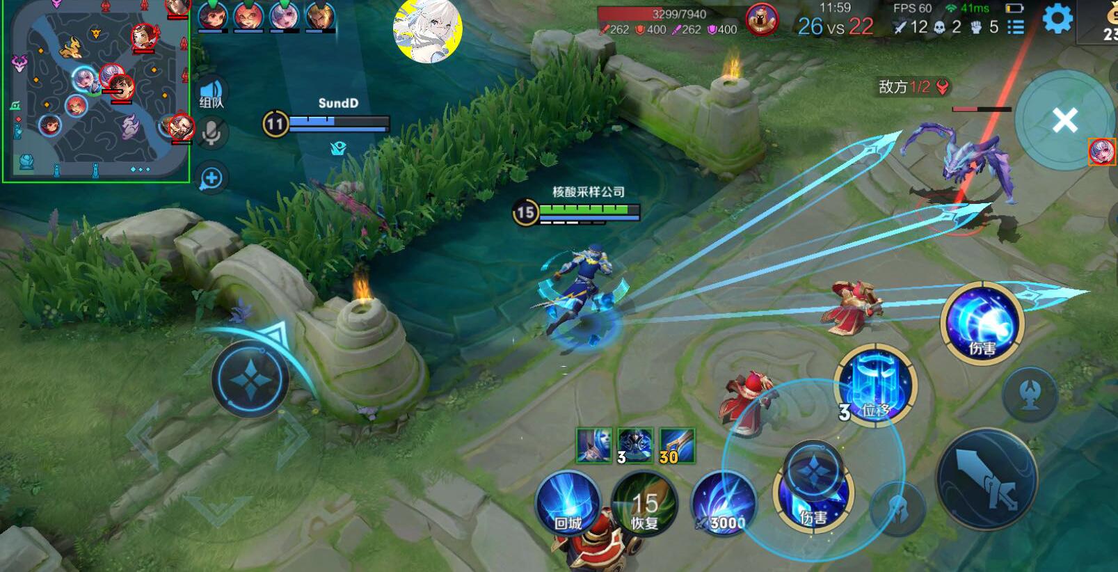 王者荣耀外挂《天眼》iOS直装